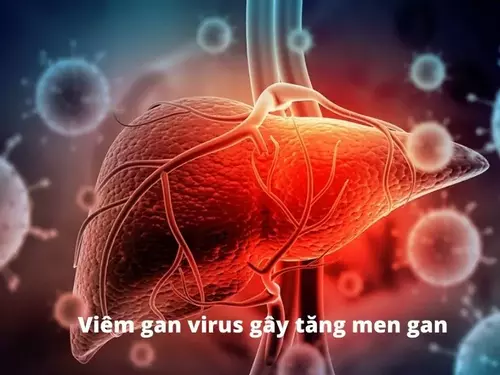 Viêm gan virus là nguyên nhân chính gây ra men gan cao.webp